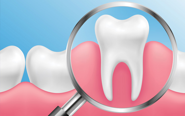 Treatment - Carnaby Street Dental